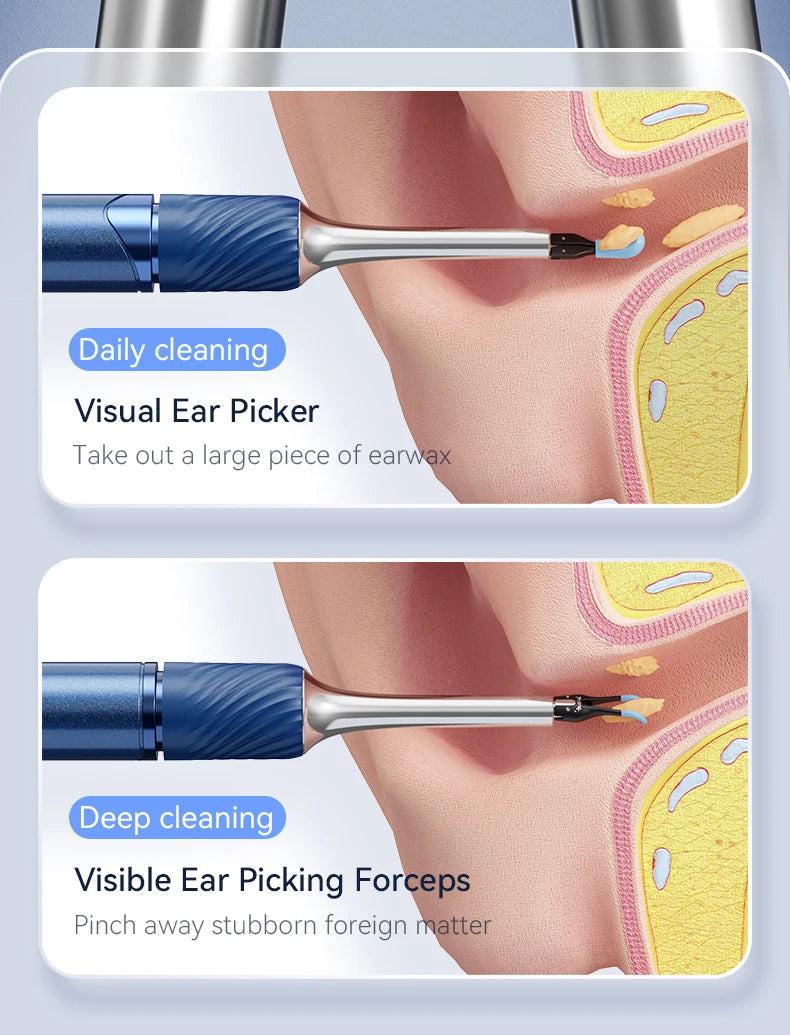 Ear Wax Removal 2-in-1 Visual Otoscope Ear Cleaner Tweezers with 6 Ear Spoon Earwax Removal Kit with Light  Ear Cleaner